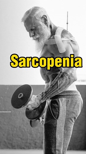 La sarcopenia (del griego sarx, carne, y penia, pobreza) es la pérdida involuntaria de masa muscular esquelética que se produce con la edad avanzada1. La masa muscular declina aproximadamente un 3-8% por década a partir de los 30 años, y esta tasa se acelera por encima de los 60 años. El tratamiento de la sarcopenia se basa fundamentalmente en el ejercicio físico y una dieta sana, con una adecuada ingesta de calorías y proteínas. Para ello, en algunos casos, debe considerarse la suplementación c