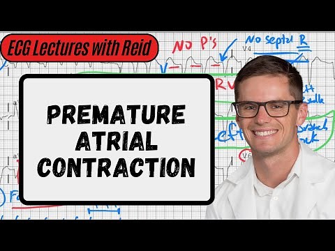 Premature Atrial Contractions | Day 2 ECG Challenge