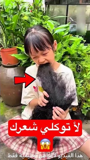 اكلت شعرها والسبب صدمة…!#shorts #shortvideo #shortsfeed #اسلاميات