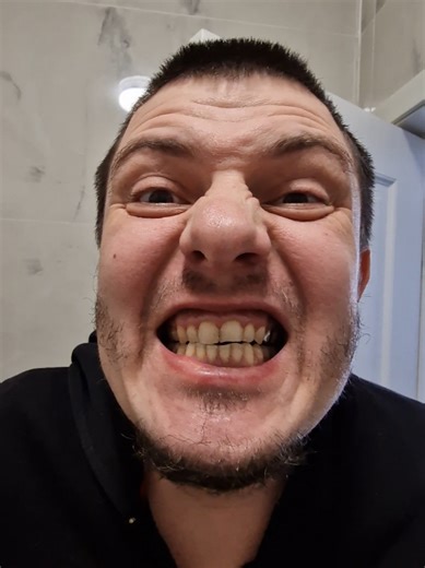 Brushing Teeth Every Four Days: Is It Enough?