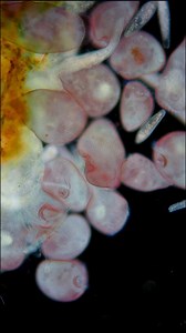 5.2K views · 14 reactions | The Stentor, a unicellular protozoan with a striking intense pink color, is one of the wonders of the microscopic world. It can regenerate even if cut into pieces and contracts like an accordion.  #science #biology #microscopy which one next? | Science into Images | Facebook