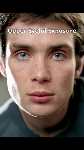 Free Face Scan at FaceIQLabs — Quick 3D Face Capture