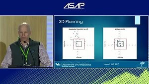 CT: The New Gold Standard for Pre-op Imaging - What About MRI & Ultrasound?