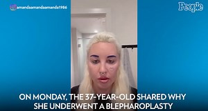 Amanda Bynes Says Bleph Surgery Was ‘One of the Best Things’ She's Done for Her Confidence
