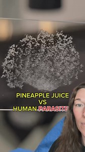 I am shook I never knew it was to this extent with pineapple But this is what it’s so important to bind and realize some foods are anti-parasitc food but they are so important to eat! You can eat pineapple on the ParaFy cleanse too! It will add additional suppprt like pumpkin seeds do! #pineapple #pineapplejuice #parasites #worms #wormqueen #foodie #antiparasiticdiet | Kim Rogers