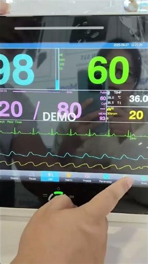 vet hospital patient monitor vet clinic monitor touch screen EtCo2 sensor