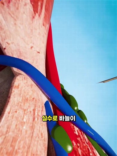 혈관 손상과 인체 보존 방법에 대한 과학