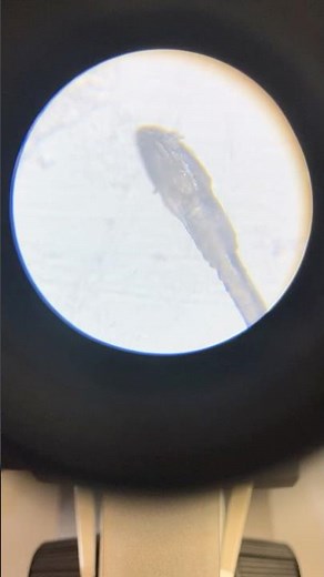 Hair under the microscope…