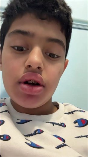 I did a lip challenge and it turned big