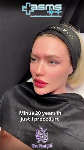 Full Face Complex Treatments: Complete Rejuvenation & Harmony ✨💎