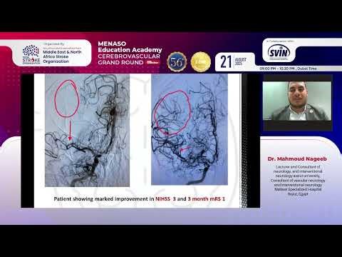 The 56th MENASO Education Academy – Cerebrovascular Grand Round | July 2025