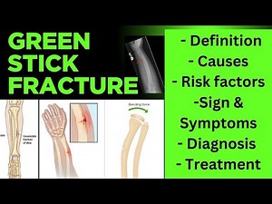 Green stick fracture- definition, causes, risk factors, sign and symptoms, diagnosis, treatment.