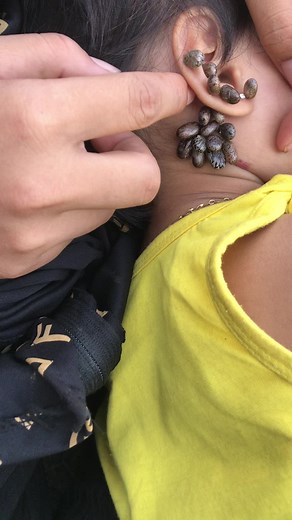 What is you ticks #ticks #foryou #omg #fyp