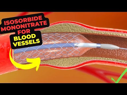 Benefits of Isosorbide Mononitrate: improving blood flow