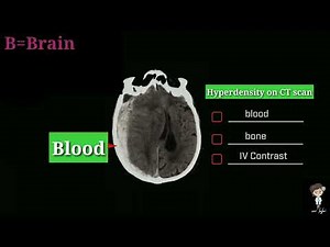 How to read CT scan brain in 5 minutes with mnemonics