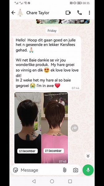 Wow#SAMA28 #haircare #becomeoneofthem #fasthairgrowth #supportlocal #beautifulhair #personalcare #healthyhair #rapanzelsecret #growyourhair #hairgrowthconditioner