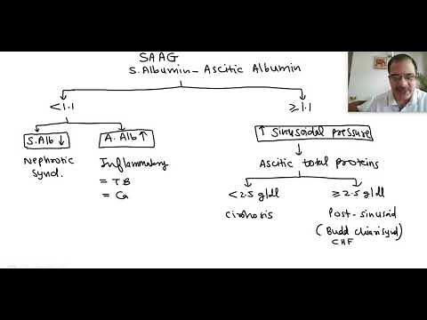 Clinical approach to a case of ascites | Dr Arvind Kumar