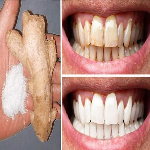 White Teeth with Ginger One of the teeth whitening home remedies includes using ginger. Ginger has anti-inflammatory properties that make your mouth tissue healthy. It is the basis for white teeth and a healthy smile. Adding ground ginger to savory or drinking ginger tea promotes anti-inflammatory properties. | Health Zone