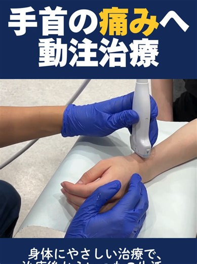 手首の痛みを軽減する新しい治療法