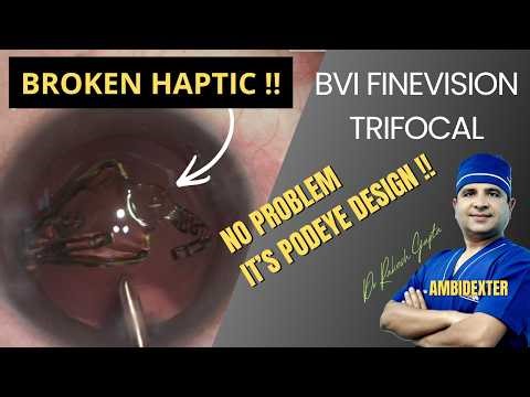 Broken Haptic of BVI FineVision Trifocal- What to do ?