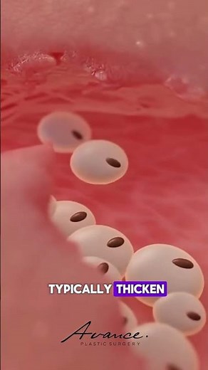 The Three Different Phases of Wound Healing | Avance Plastic Surgery Institute: Dr. Erez Dayan