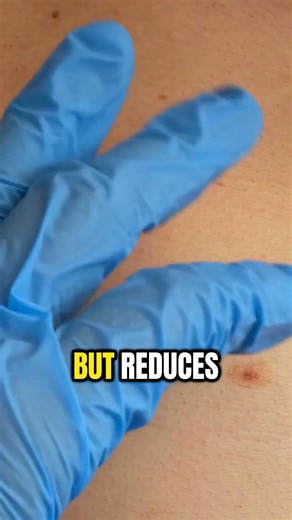 What to avoid with prostatitis #prostate #diet #menshealth