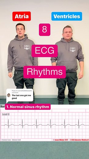 The Medical Lounge on Instagram: "8 ECG rhythms through the medium of dance . . 👊 Hit follow & like for more prehospital content . . 🖥️ head over to www.themedicallounge.co.uk and sign up for incoming educational courses and quizzes. . . 🛒 Head over to our Etsy shop www.themedicallounge.etsy.com for prehospital products . . 📸 Jason Winter 2017: ECG educator and medical illustrator . . Links also in bio . . #ecg #ecginterpretation #ecgreading #ecglovers #ecglearnin