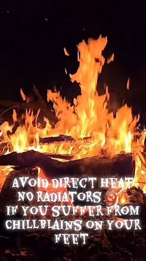 Chilblains on your feet? Don’t ignore the signs! 👣 Cold, damp weather can cause painful red or purple patches on your toes and heels known as chilblains. They can itch, burn, and even become infected if left untreated! 😣 ✨ Prevention is key: 🧦 Keep feet warm and dry 🔥 Warm up slowly after being in the cold 🚶‍♀️ Stay active to boost circulation 👟 Wear properly fitting shoes 🧴 Moisturise your skin 🚭 Quit smoking it improves blood flow ❌ Avoid direct heat 🔥 Keep your feet happy and healthy