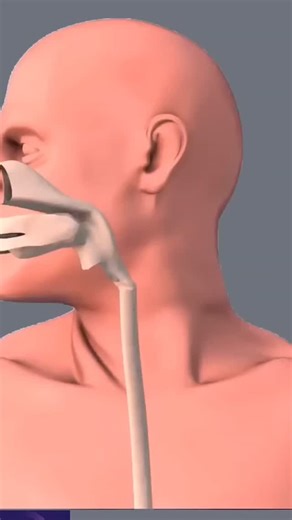 Nb on Instagram: "Stomach Endoscopy Procedure - 3D animation"