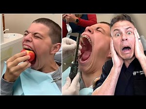 How Is It Possible To Open Your Mouth This WIDE!?