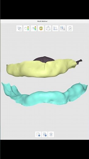 How to create a Digital Immediate Denture