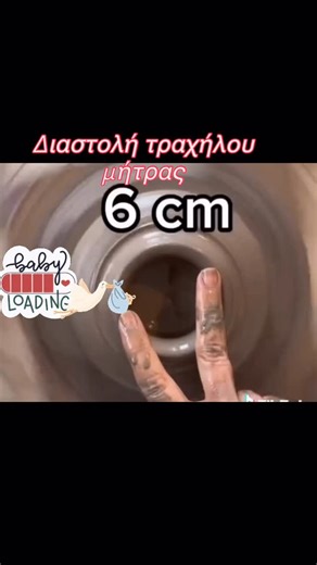 Δοξα Τερζη | μαία | φυσιολογικός τοκετός | θηλασμός | Διαστολή τραχήλου μήτρας και δημιουργία | Instagram