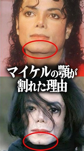 The reason Michael Jackson's jaw became cleft