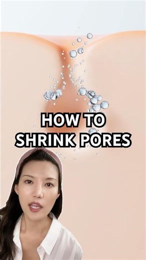 Why pore vacuum won't fix your problem (do this instead) #skincare #porecare