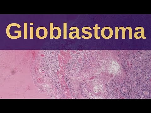 What is a Glioblastoma? - Pathology mini tutorial