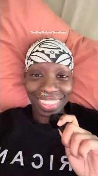 My Day Before Chemotherapy