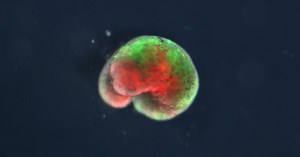 Half frog, half machine: The rise of the xenobot