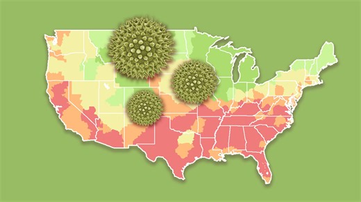 Feeling seasonal allergy symptoms? Pollen counts are high