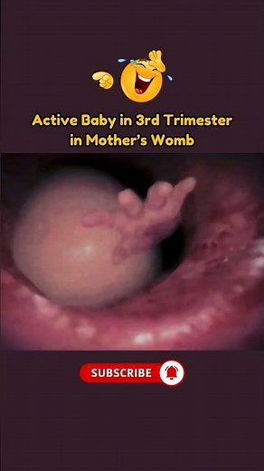 Active Baby in 3rd Trimester Playing in Mother's Womb🤣