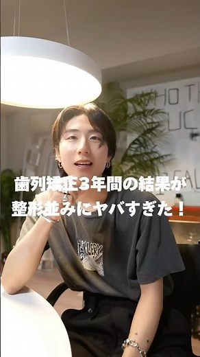 【ついに完成！】歯列矯正3年間の結果を公開！整形級の変化がヤバすぎた！ #歯列矯正 #整形級 #ビフォーアフター