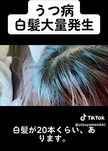 ストレスから白髪急増！座るのが苦痛、美容師とも話しかけられず…ロングヘアも素敵❤️