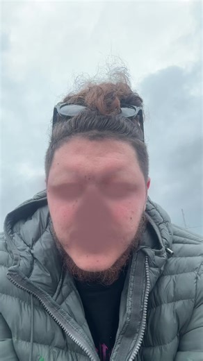 Oh noooo #funny #fyp #face #filter #audio