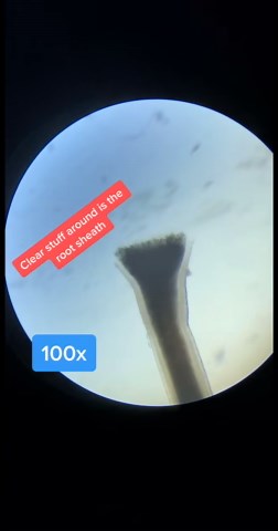 You Asked for Hair Under the Microscope – Here It Is!