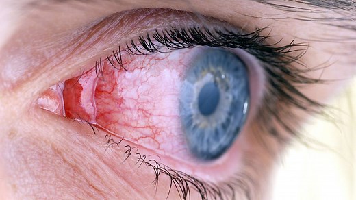 The immune system - Non-specific body defences - Higher Human Biology Revision - BBC Bitesize