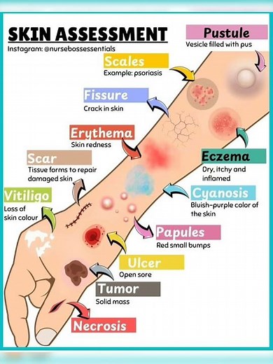 🩺 SKIN ASSESSMENT | Nursing Skills & Physical Examination | NCLEX Review Welcome to today’s nursing.