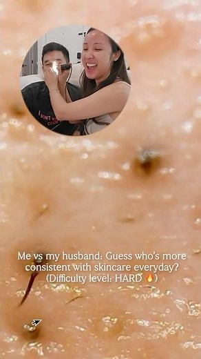 WARNING ⚠️ Exposing our *nasty* pores under a microscope 🔍 😵
