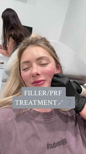 What is PRF? Platelet rich fibrin is what the abbreviation stands for. PRF is a natural, injectable treatment that uses our own blood to rejuvenate skin, increase hair growth, and heal injuries, treat undereye dark spots/eye bags, etc. I usually do this treatment every 6 months, or so! I have mixed in PRF with filler in the past, but I have been educated to stick with PRF and stat away from filler in that area. There are so many opinions/advice with aesthetic/cosmetic procedures, so make sure yo