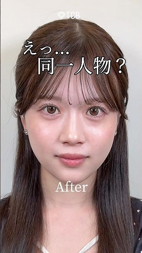 [Hyaluronic Acid] Is this the same person? #shorts