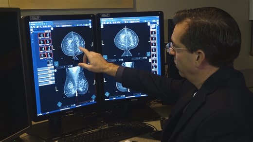 Riverside Health System using AI for 3D mammograms to help detect breast cancer