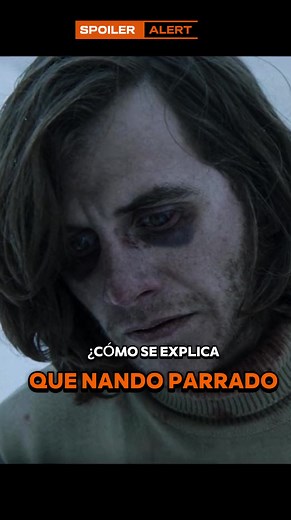 Hematomas de Nando Parrado en 'La Sociedad de las Nieves'